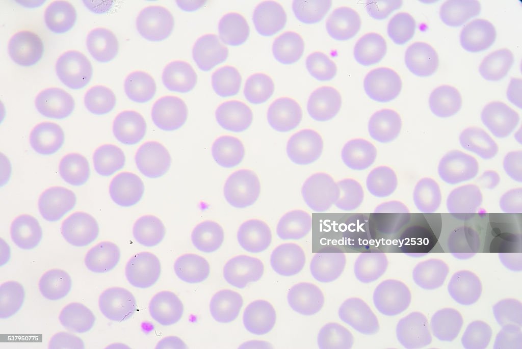 blood smear 2015 Stock Photo