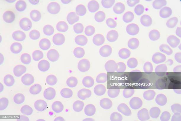 Blood Smear Stock Photo - Download Image Now - 2015, Anemia, Antigen