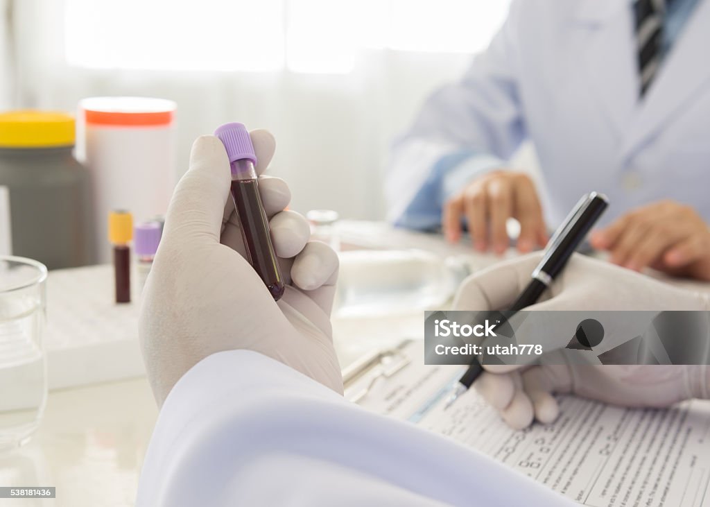 blood tests Doctor holding a bottle of blood sample in lab. science and medical concept Laboratory Stock Photo