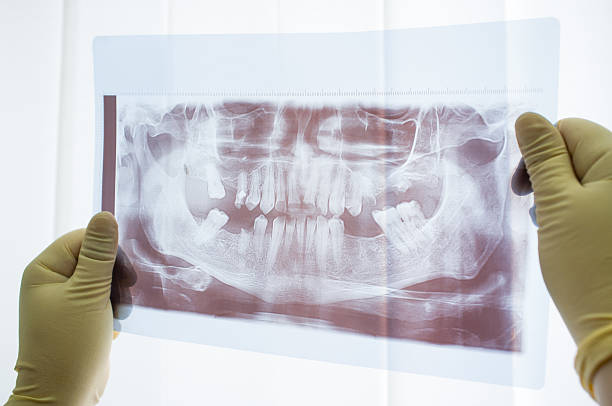 istock Dental panoramic x-ray of jaw close up 538195170