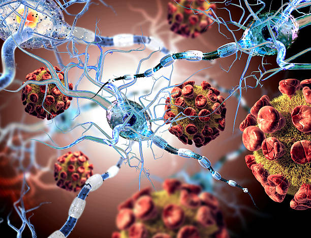 virus atacando células nerviosas, concepto de enfermedades neurológicas cirugía cerebral. - neurologic fotografías e imágenes de stock