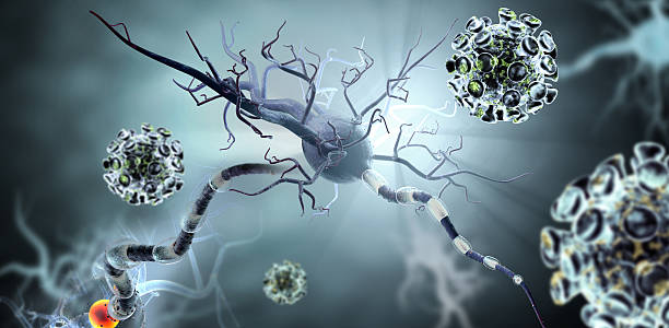 células nerviosas, concepto de enfermedades neurológicas, los tumores y cirugía cerebral. - neurologic fotografías e imágenes de stock