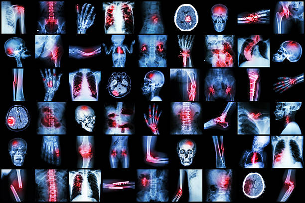 x-ray múltiples enfermedad de niños y adultos - cat scan abdomen medical scan x ray fotografías e imágenes de stock