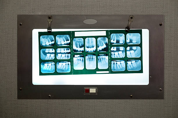 Dental X-rays. Wall lightbox in dental office with medical X-rays. lightbox photos stock pictures, royalty-free photos & images