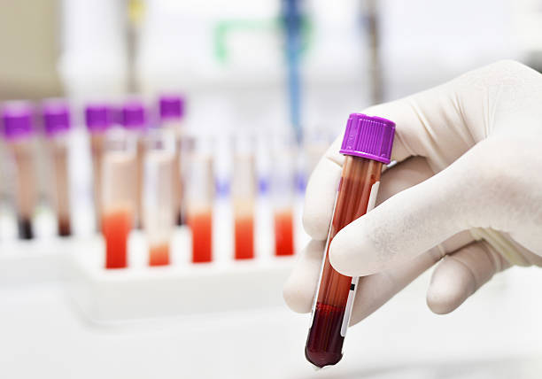 실험실 테스트 튜브 - laboratory blood laboratory equipment medical sample 뉴스 사진 이미지