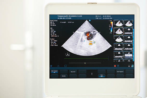moderna máquina de ultra-som - doppler effect - fotografias e filmes do acervo