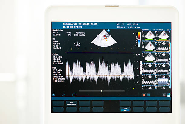 moderna máquina de ultra-som - doppler effect - fotografias e filmes do acervo
