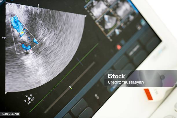 Modernen Ultraschallgerät Stockfoto und mehr Bilder von Computerbildschirm - Computerbildschirm, Ultraschall-Untersuchung, Mitralklappe