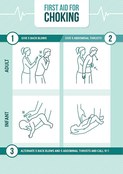 응급 처치 질식 - choking stock illustrations