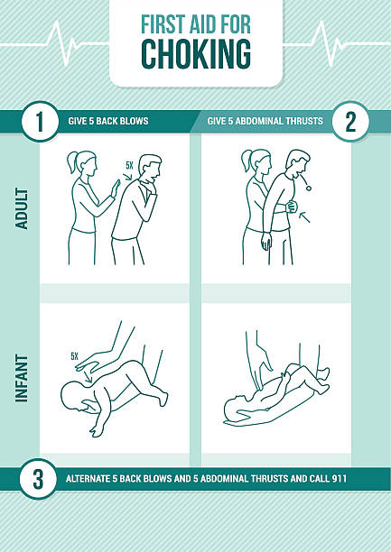 First aid for choking First aid procedure for choking and heimlich maneuver for adults and infants first aid stock illustrations