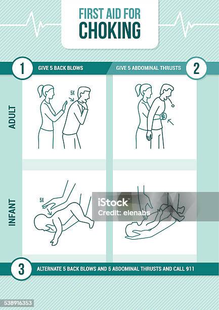 First Aid For Choking Stock Illustration - Download Image Now - Heimlich Maneuver, Strangling, Choking