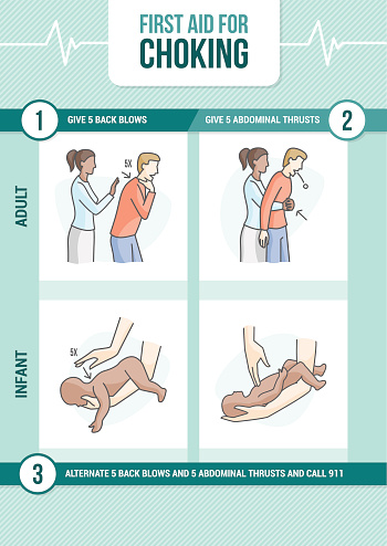 First aid procedure for choking and heimlich maneuver for adults and infants