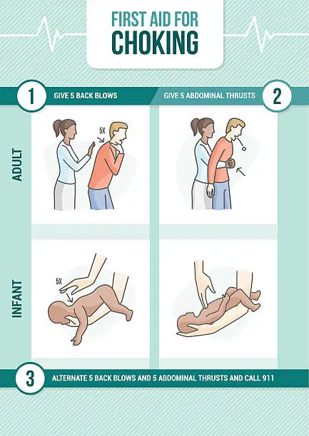 Vector illustration of Choking first aid