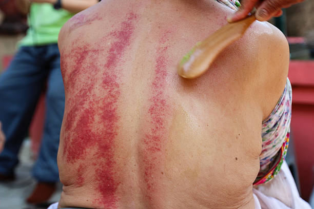 Close-up of an adult man pointing to a skin allergy on his arm against a black background
