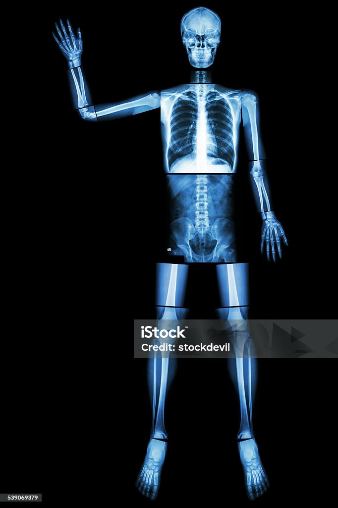 Good Bye. (Human bone wave the hand) Good Bye. (Human bone wave the hand) (Whole body : head neck spine shoulder arm elbow forearm wrist hand finger thorax heart lung back abdomen pelvis hip thigh leg knee foot ankle heel) X-ray Image Stock Photo