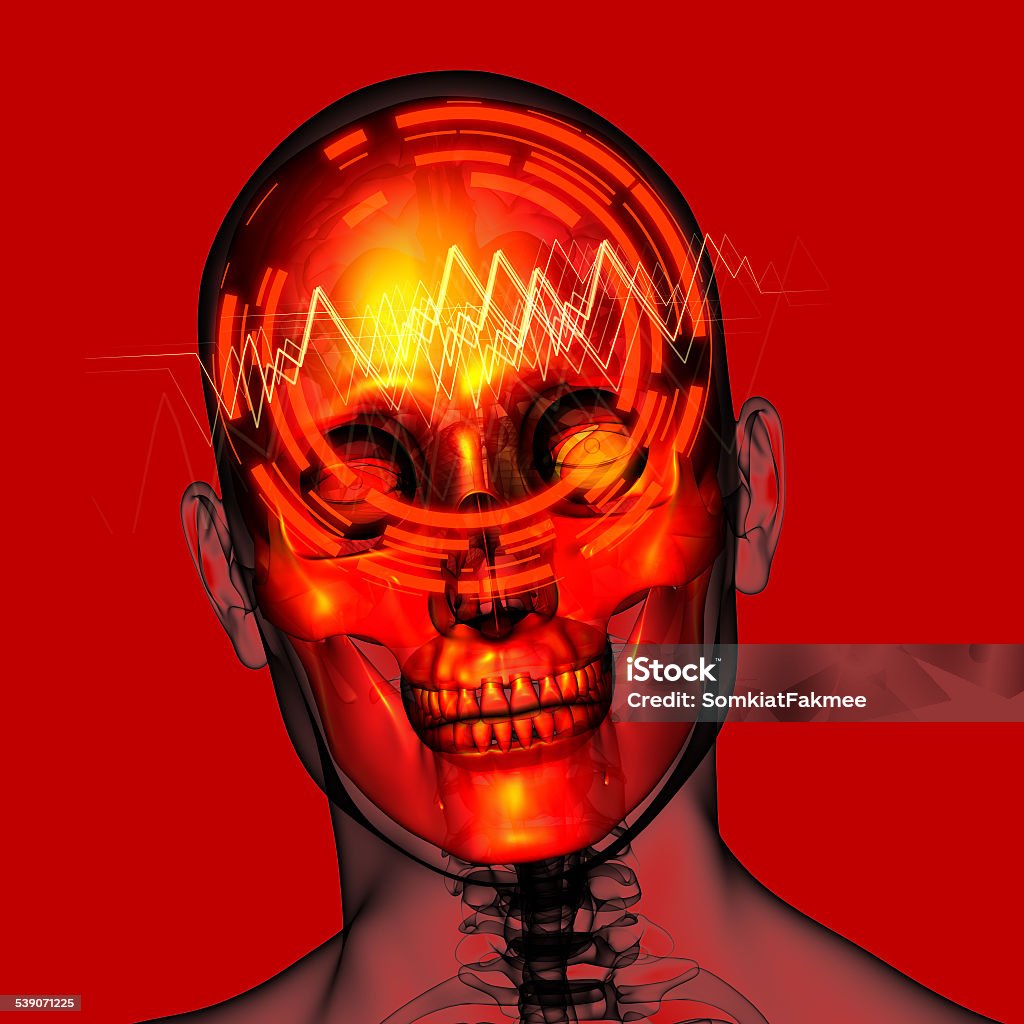 3d render medical illustration of the  head  pain 3d render medical illustration of the  head  pain - side view 2015 Stock Photo