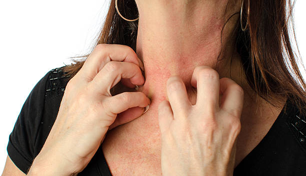Woman scratching her neck stock photo