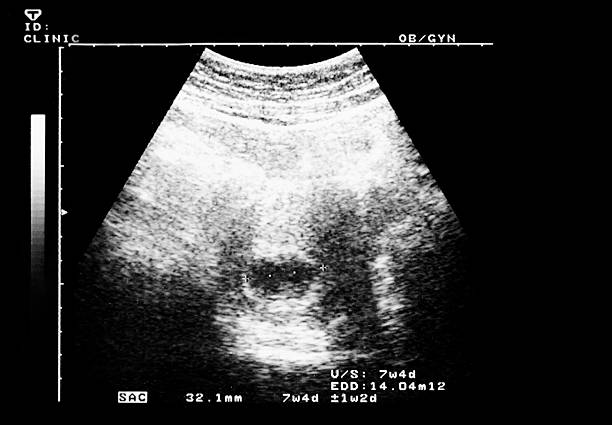 An ultrasound of a human fetus during the 7th week. An ultrasound of a human fetus during the 7th week. 7 week fetus stock pictures, royalty-free photos & images