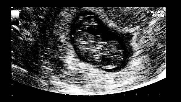 An ultrasound of a human fetus during the 7th week. An ultrasound of a human fetus during the 7th week. 7 week fetus stock pictures, royalty-free photos & images