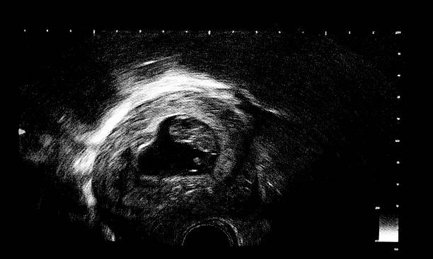 An ultrasound of a human fetus during An ultrasound of a human fetus during the 9 th week. 7 week fetus stock pictures, royalty-free photos & images