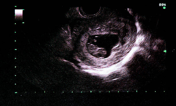 An ultrasound of a human fetus during An ultrasound of a human fetus during the 9 th week. 7 week fetus stock pictures, royalty-free photos & images