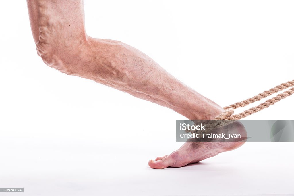 Hombre con venas varicosas - Foto de stock de Araña libre de derechos