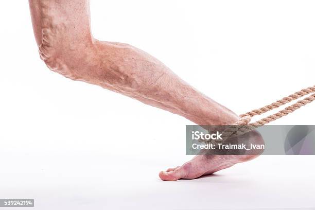 Hombre Con Venas Varicosas Foto de stock y más banco de imágenes de Araña - Araña, Asistencia sanitaria y medicina, Cirugía