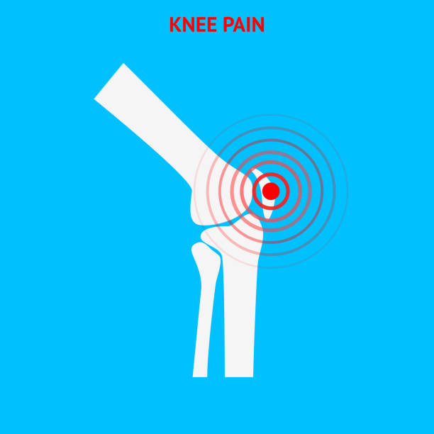 Knee pain. Knee pain icon isolated on white background. Knee pain. Knee pain icon isolated on white background. Human knee. Vector design element. hamstring injury stock illustrations