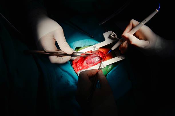 istock Pediatric heart surgery, close-up 539272649