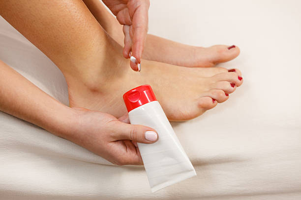 istock Woman putting ointment on bad ankle applying cream 539822006