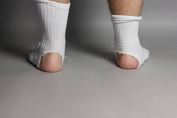 istock feet with white socks and a big hole 540212400