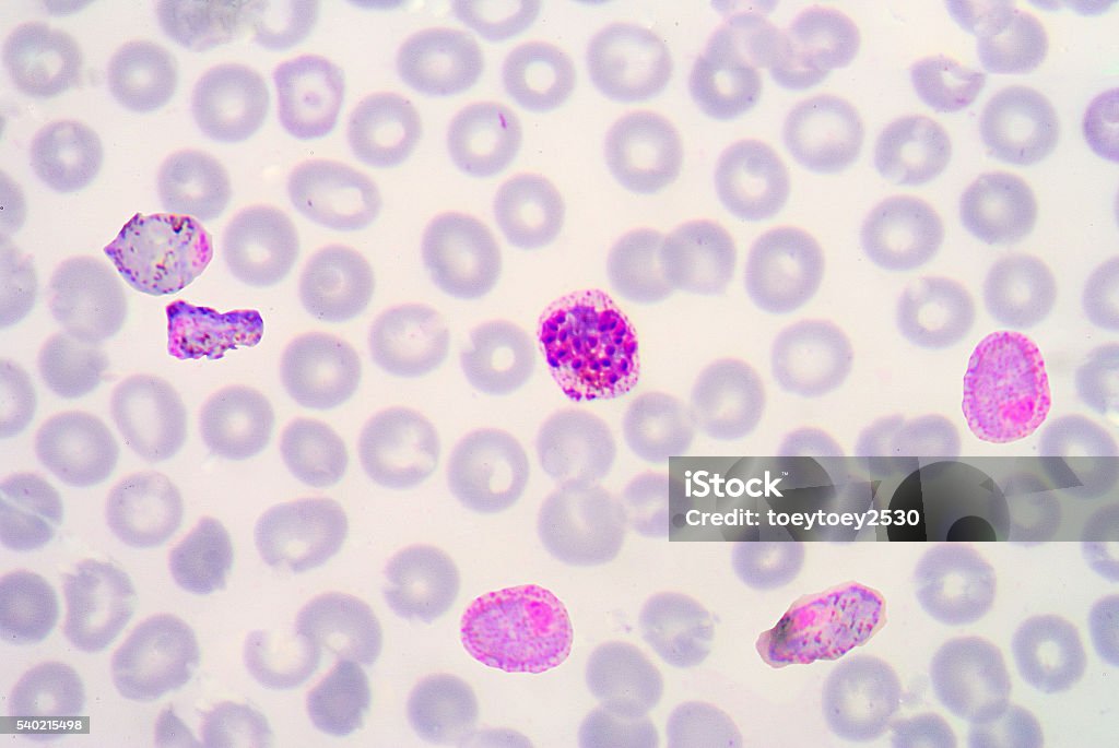 blood films for Malaria parasite. blood films for Malaria parasite.show malaria pigment. Animal Body Part Stock Photo