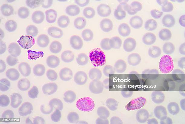 Blood Films For Malaria Parasite Stock Photo - Download Image Now - Animal Body Part, Anopheles Mosquito, Biology