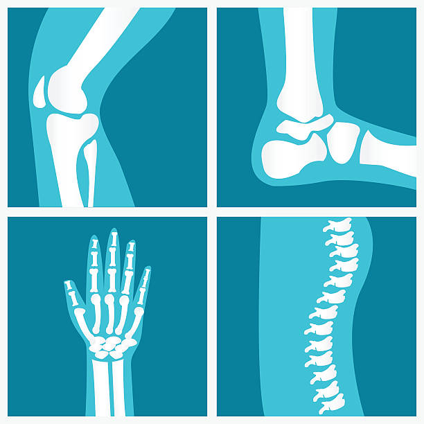 ilustrações de stock, clip art, desenhos animados e ícones de conjunto de articulações humanas. - human joint human knee pain x ray
