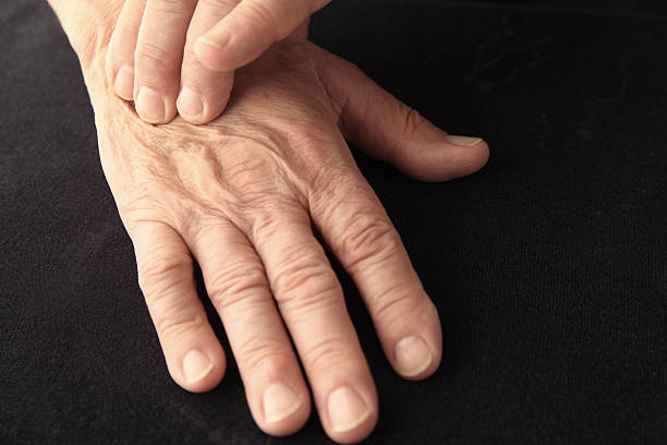 istock Older man has painful hand 540513840
