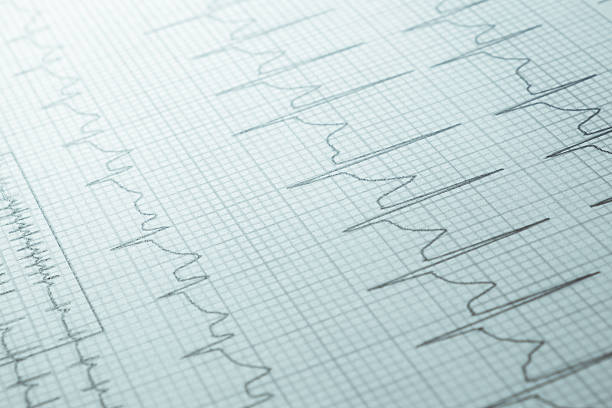 istock Close up of an electrocardiogram in paper form 540762820