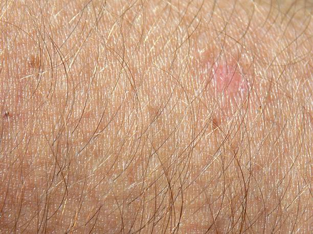 istock Human skin detail 541121392