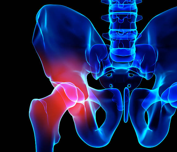 radiografía del esqueleto doloroso de la cadera, ilustración 3d. - ilium fotografías e imágenes de stock