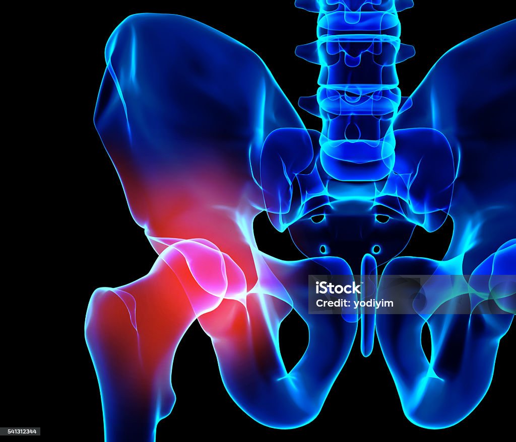 Hip painful skeleton x-ray, 3D illustration. 3D illustration, hip painful skeleton x-ray, medical concept. Hip - Body Part Stock Photo