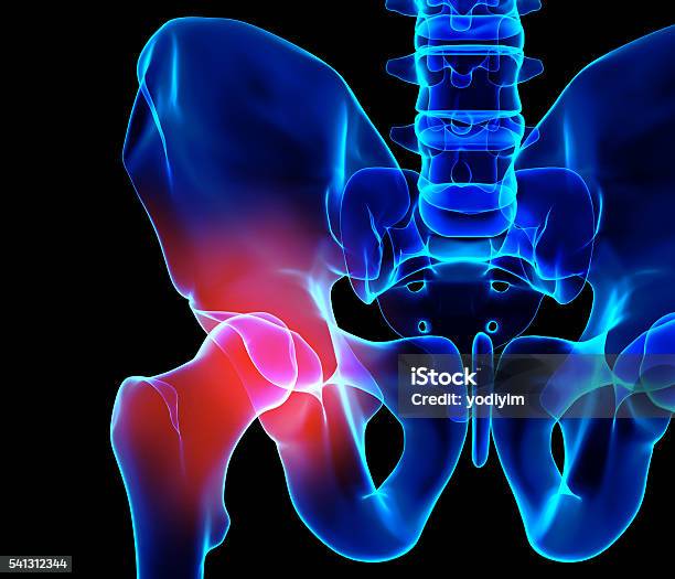 Hip Painful Skeleton Xray 3d Illustration Stock Photo - Download Image Now - Hip - Body Part, Pain, Joint - Body Part