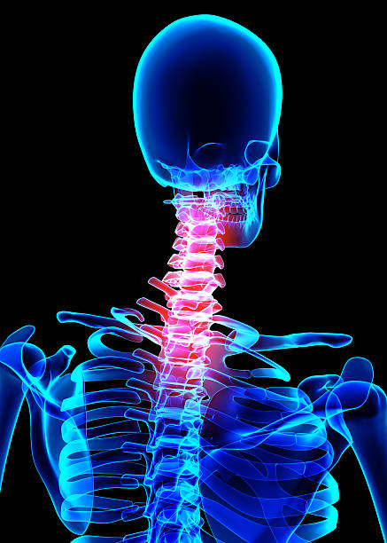 istock Neck painful skeleton x-ray, 3D illustration. 541566338