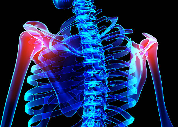 istock Shoulder painful skeleton x-ray, 3D illustration. 541566894
