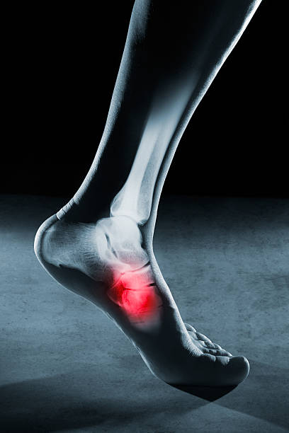 人間の足の足首とx線の足 - radiogram photographic image ストックフォトと画像