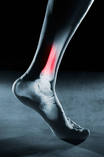 istock Human foot ankle and leg in x-ray 541847178