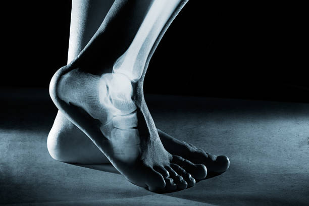 tornozelo e perna humanos em raio-x - tornozelo - fotografias e filmes do acervo