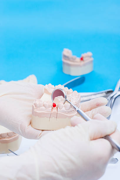 istock Dentist examinates the teeth mold 541979302