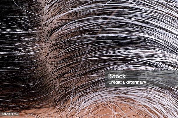 Going Gray Woman Gray And Black Hair Roots Stock Photo - Download Image Now - Hair Follicle, Gray Color, Gray Hair