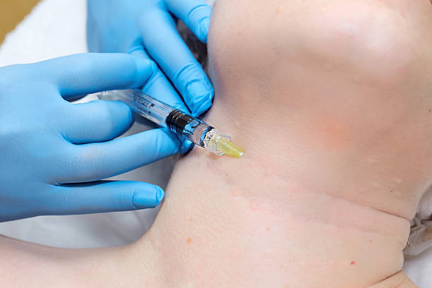 istock Anti-age injection therapy. Wrinkles reduction. 542203104