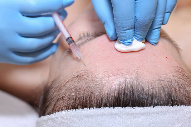 istock Anti-age injection therapy. Mimic wrinkles reduction. 542205706