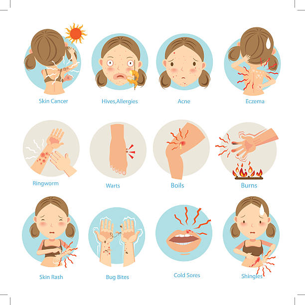 ilustrações de stock, clip art, desenhos animados e ícones de problemas de pele - sintoma ilustrações